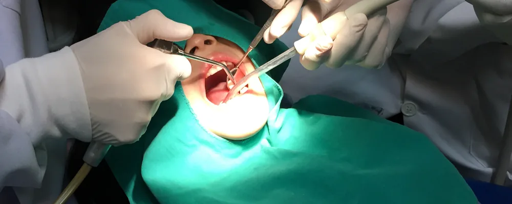 子どもが口を大きく開け、歯科医師が器具を使って中を確かめている様子｜獨協大学前シティデンタルクリニック