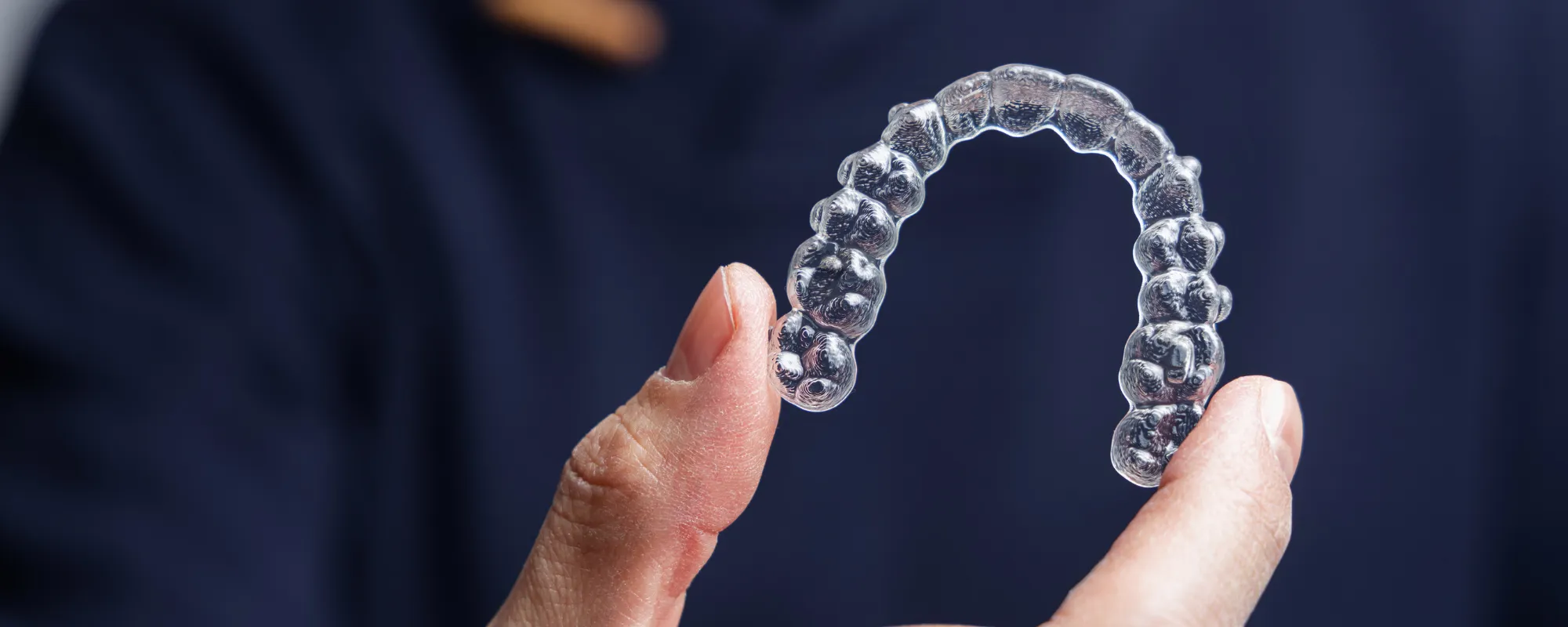 カウンセリングでシステムの違いについて質問しているイメージ｜獨協大学前 シティデンタルクリニック トーブイコート