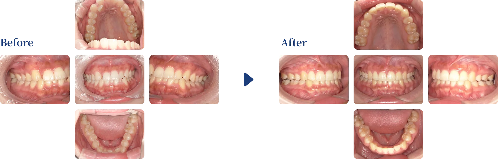 before & after