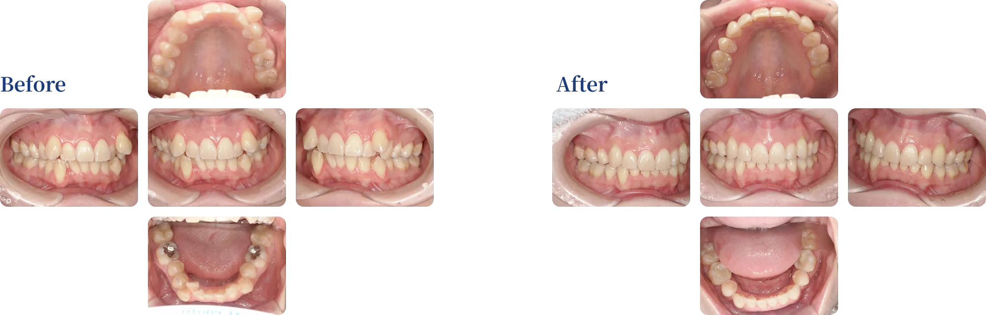 before & after