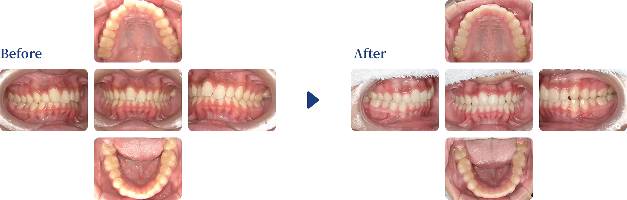 before & after